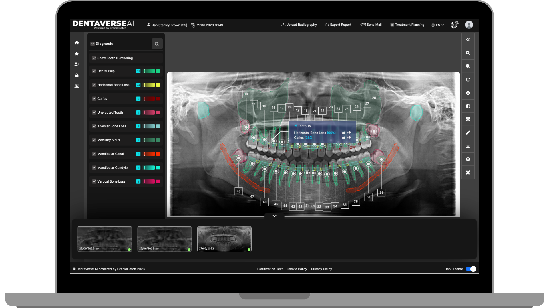Dentaverse IQ Beta Access